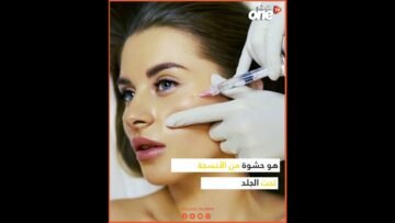لا تجربوا البوتوكس أو الفيلر قبل هذه السن