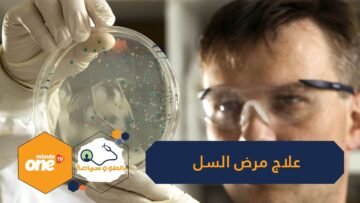 طرق علاج مرض السل