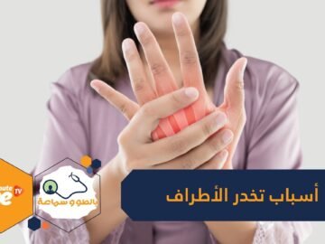 هل تشعر بخدر متكرر في أطرافك؟ احذر قد يكون مؤشرا لمشكلة صحية خطيرة