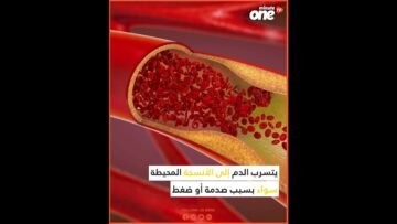 ما الذي يسبب الكدمات؟