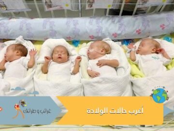 شاهد أغرب حالات الولادة علي مر التاريخ!!!