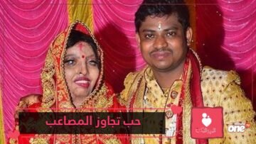 شاهد.. تعثر على فتى أحلامها بعدما تعرضت لهجوم بالأسيد