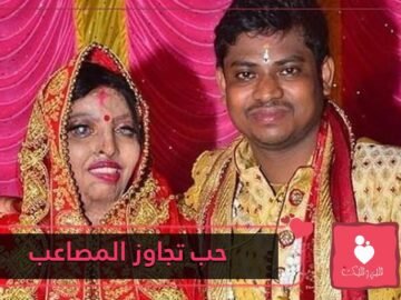 شاهد.. تعثر على فتى أحلامها بعدما تعرضت لهجوم بالأسيد