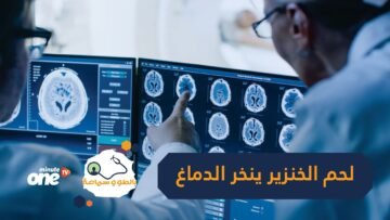 دود ينخر الدماغ بسبب تناول لحم الخنزير.. اكتشاف يرقات دودة شريطية في مخ امرأة أسترالية