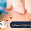 نوتا ابتكار مذهل للكشف عن الشامات السرطانية