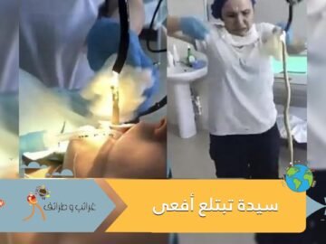 حادثة غريبة.. سيدة تبتلع أفعى عملاقة أثناء نومها