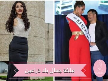 بلا ذراعين.. ملكة جمال تتحدى مفاهيم الجمال التقليدية
