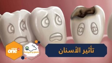 هكذا تؤثر الأسنان على صحة بقية أعضاء الجسد