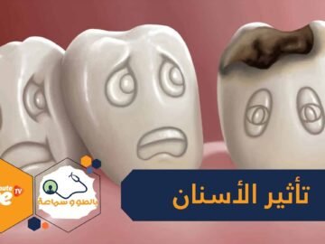 هكذا تؤثر الأسنان على صحة بقية أعضاء الجسد