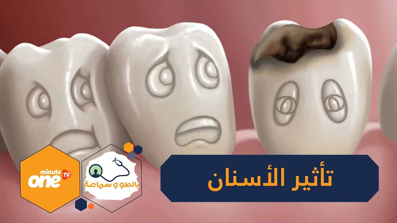 التحميل المسبق صورة