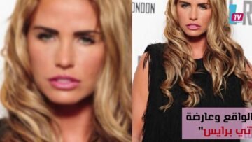 جنون أم عقل.. صرفتا مبلغًا خياليا ليشبها ممثلة والنتيجة مسخ