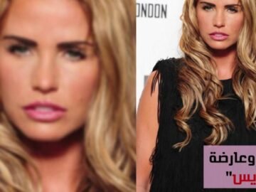 جنون أم عقل.. صرفتا مبلغًا خياليا ليشبها ممثلة والنتيجة مسخ