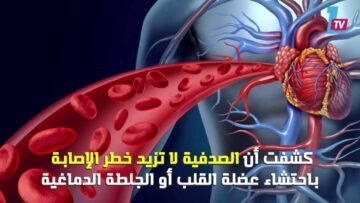 مرضى الصدفية الوراثية أكثر عرضة للأزمات القلبية والسكتة الدماغية