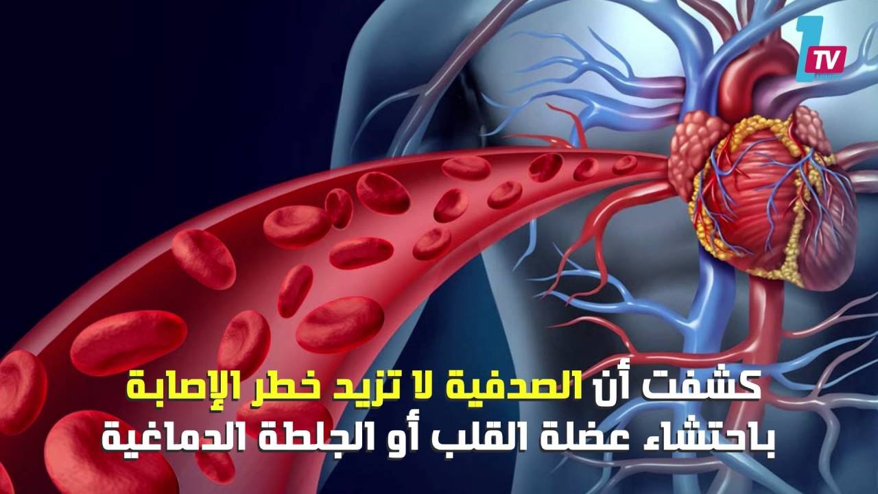 التحميل المسبق صورة