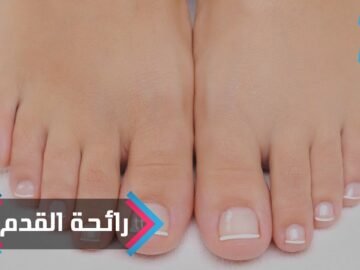 رائحة القدم المزعجة   تخلص منها في 6 خطوات