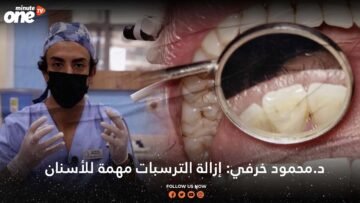د.محمود خرفي: إزالة الترسبات مهمة للأسنان