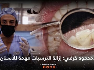 د.محمود خرفي: إزالة الترسبات مهمة للأسنان