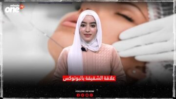 علاقة الشقيقة بالبوتوكس