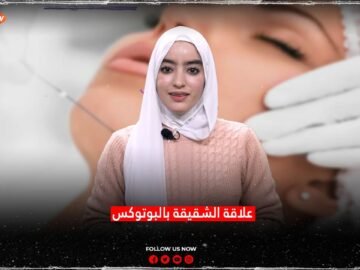 علاقة الشقيقة بالبوتوكس