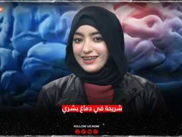 الشريحة الدماغية