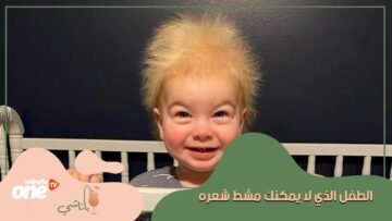 شعر هذا الطفل لا يمكن مشطه    إليكم قصته