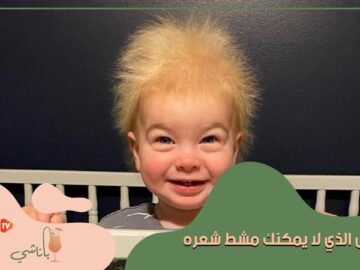 شعر هذا الطفل لا يمكن مشطه    إليكم قصته