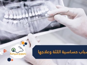 قد تكون علامة على مشكلة صحية أكثر خطورة   تعرف على أسباب حساسية اللثة وطرق علاجها