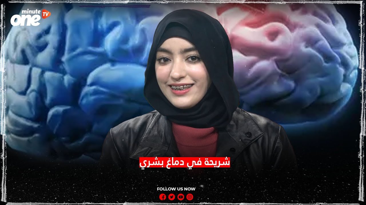 التحميل المسبق صورة