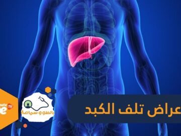 11 علامة على أنك تعاني من تلف الكبد   منها التعب المزمن