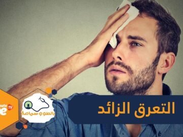15 سبب للتعرق الزائد ومتى يستوجب مراجعة الطبيب؟