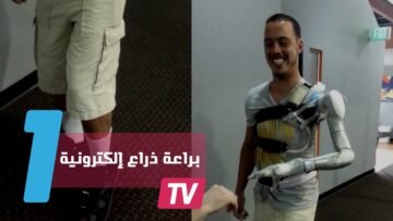 ذراع إلكترونية تحاكي وظيفة الذراع المفقودة