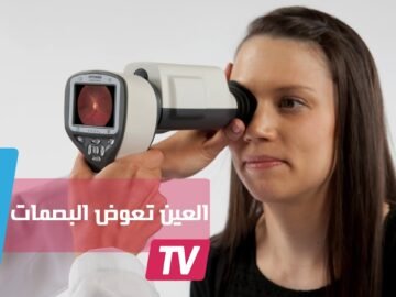 قزحية العين تعوض بصمات اليد