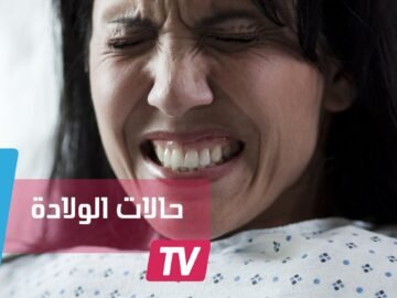 أغرب حالات الولادة