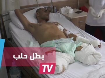 بطل حلب.. ضحى بساقيه لينقذ العشرات