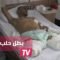 بطل حلب.. ضحى بساقيه لينقذ العشرات
