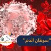 اكتشف العلاج الجديد لسرطان الدم الحاد