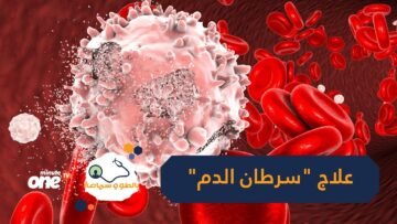 اكتشف العلاج الجديد لسرطان الدم الحاد