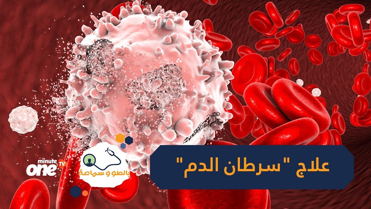 التحميل المسبق صورة