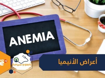 ما هي أعراض الأنيميا وكيف تعرف أنك مصاب بها؟