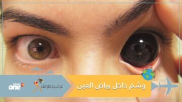 وشم داخل بياض العين يقود إلى كارثة.. والسجن ينتظر  المذنب