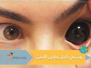 وشم داخل بياض العين يقود إلى كارثة.. والسجن ينتظر  المذنب