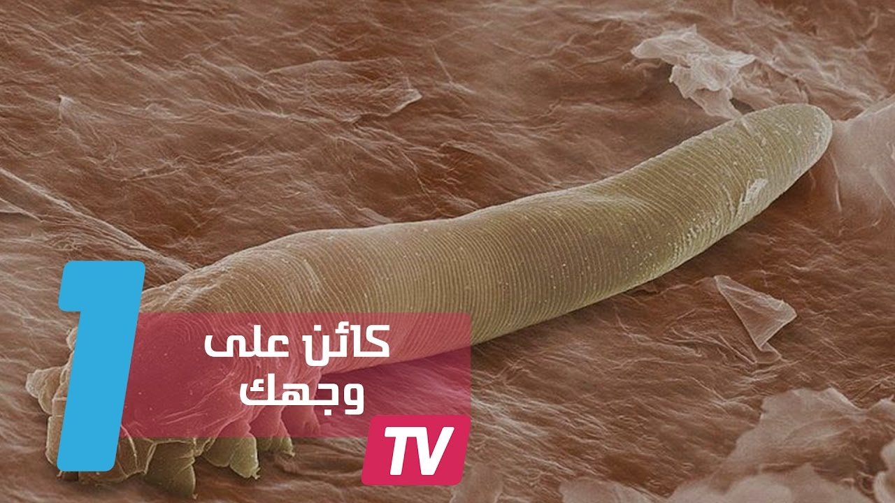 التحميل المسبق صورة