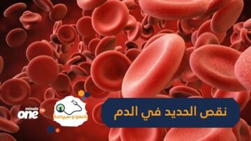 هذا كل ما تريد معرفته عن نقص الحديد في الدم وكيفية تعويضه