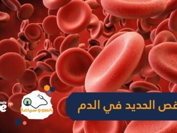 هذا كل ما تريد معرفته عن نقص الحديد في الدم وكيفية تعويضه