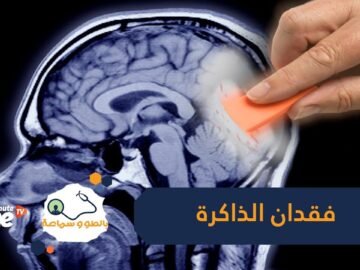 تعرف على  أغرب  حالة طبية   ذاكرة فتاة تعيد ضبط نفسها كل ساعتين