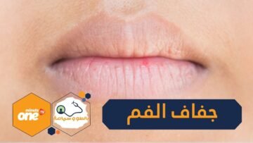 كيف يواجه كبار السن جفاف الفم؟
