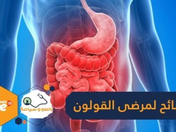 لمرضى القولون العصبي  نصائح تقلل من الأعراض المصاحبة له في رمضان