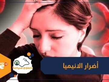 منها الأرق وألم في الصدر تعرف على أضرار الانيميا!