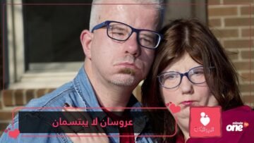 علاقة حب فريدة من نوعها عروسان لن يبتسما في زفافهما بسبب مرض نادر