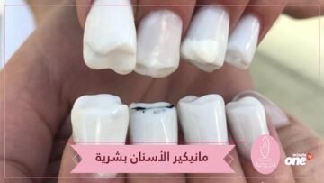 آخر موضة   تحويل الأظافر إلى أسنان بشرية!